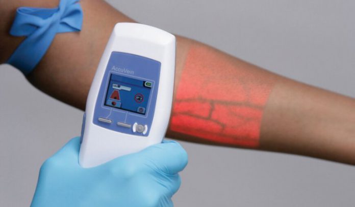 Are Vein Finders Good for Nurses