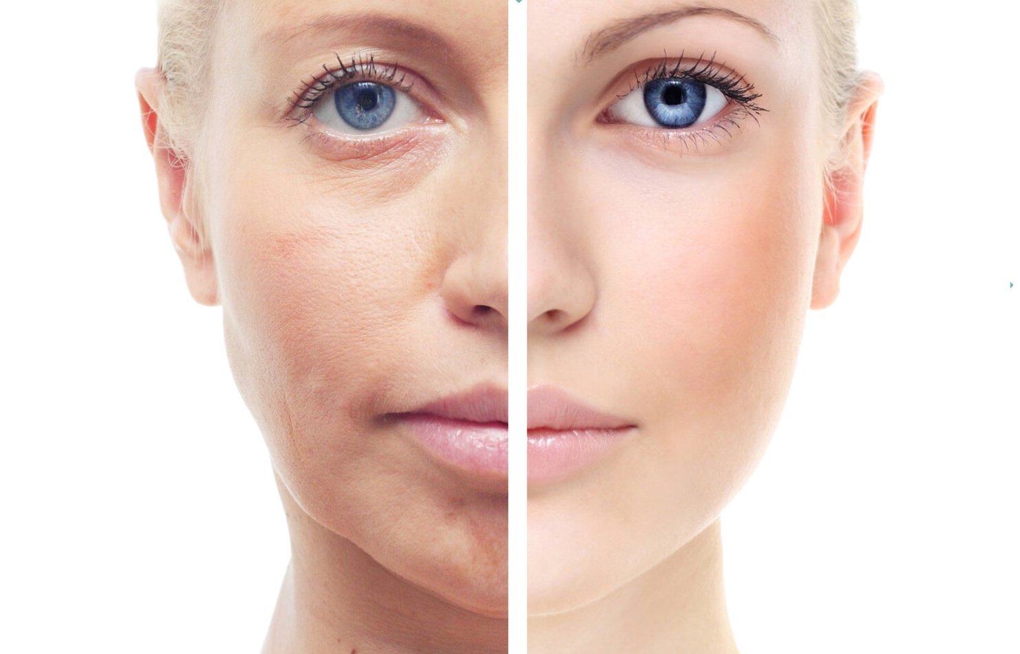Shock Facial treatment using electrical stimulation to revitalize the skin, reduce fine lines, and improve skin tone and texture.